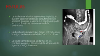 FISTULAS
 La fistula entre el colon sigmoideo y la piel (que
pueden obedecer al drenaje percutáneo de un
absceso), la vejiga, la vagina o el intestino delgado
son complicaciones muy comunes de la
diverticulitis
 La diverticulitis produce más fistulas entre el colon y
la vejiga que la enfermedad de Crohn o el cáncer.
 La fistula sigmoidovesical se da más en los
hombres, porque el útero impide la adherencia del
sigma a la vejiga femenina.
 