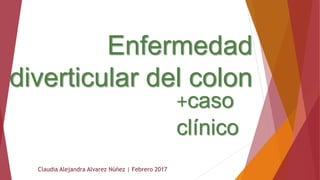 Enfermedad
diverticular del colon
Claudia Alejandra Alvarez Núñez | Febrero 2017
+caso
clínico
 
