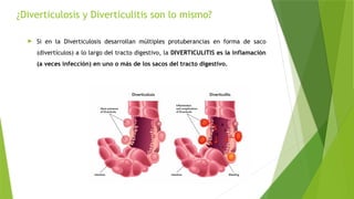 ¿Diverticulosis y Diverticulitis son lo mismo?
 Si en la Diverticulosis desarrollan múltiples protuberancias en forma de saco
(divertículos) a lo largo del tracto digestivo, la DIVERTICULITIS es la inflamación
(a veces infección) en uno o más de los sacos del tracto digestivo.
 