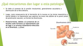 ¿Qué mecanismos dan lugar a esta patología?
 Se debe al aumento de la presión intraluminal, generalmente secundaria a
disminución de la fibra dietaria.
 Luego, como consecuencia de la herniación de la mucosa en las tenias mesentérica y
lateral debido a la hiperpresión que soportan las áreas más débiles de la pared (zonas
de penetración vascular), se forman los divertículos.
 Posteriormente, debido a la presencia de un
fecalito suele formarse un taponamiento que
da lugar a un proceso inflamatorio-infeccioso
en el Diverítulo… y ¡Pum!
 