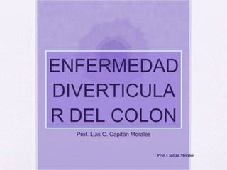 ENFERMEDAD DIVERTICULAR DEL COLON Prof. Luis C. Capitán Morales Prof. Capitán Morales 