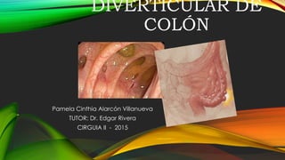 DIVERTICULAR DE
COLÓN
Pamela Cinthia Alarcón Villanueva
TUTOR: Dr. Edgar Rivera
CIRGUIA II - 2015
 
