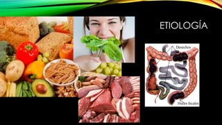 ETIOLOGÍA
 