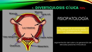 FISIOPATOLOGÍA
Sigmoides se ve comúnmente
afectado, probablemente debido a
su diámetro pequeño.
segmentación del colon y la generación de
elevadas presiones intracólicas
1. DIVERTICULOSIS CÓLICA 75%
 