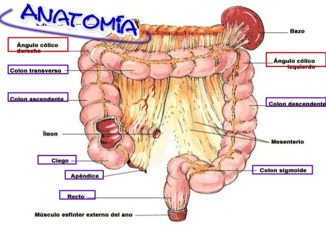 Enfermedad diverticular de colon