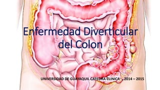 Enfermedad Diverticular
del Colon
UNIVERSIDAD DE GUAYAQUIL CATEDRA CLINICA 2014 – 2015
 