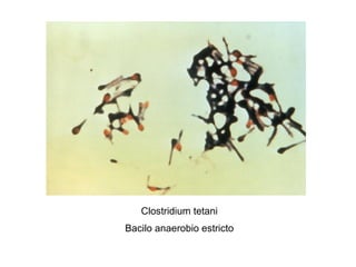 Clostridium tetani Bacilo anaerobio estricto 