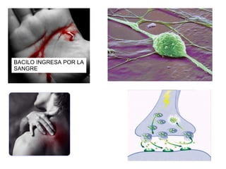 BACILO INGRESA POR LA SANGRE 