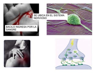 BACILO INGRESA POR LA SANGRE SE UBICA EN EL SISTEMA NERVIOSO 