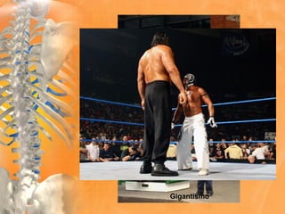Gigantismo
 