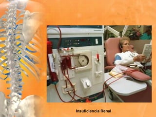 Insuficiencia Renal
 