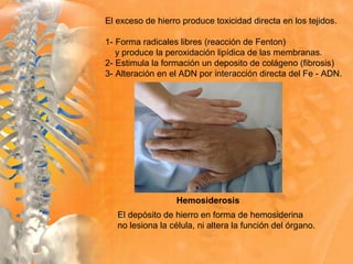 Hemosiderosis
El depósito de hierro en forma de hemosiderina
no lesiona la célula, ni altera la función del órgano.
El exceso de hierro produce toxicidad directa en los tejidos.
1- Forma radicales libres (reacción de Fenton)
y produce la peroxidación lipídica de las membranas.
2- Estimula la formación un deposito de colágeno (fibrosis)
3- Alteración en el ADN por interacción directa del Fe - ADN.
 