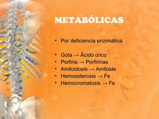 • Por deficiencia enzimática.
• Gota → Ácido úrico
• Porfiria → Porfirinas
• Amiloidosis → Amiloide
• Hemosiderosis → Fe
• Hemocromatosis → Fe
METABÓLICAS
 