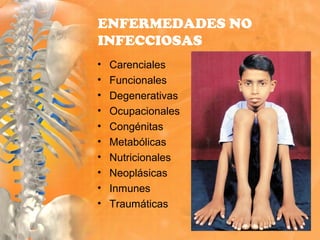 ENFERMEDADES NO
INFECCIOSAS
• Carenciales
• Funcionales
• Degenerativas
• Ocupacionales
• Congénitas
• Metabólicas
• Nutricionales
• Neoplásicas
• Inmunes
• Traumáticas
 