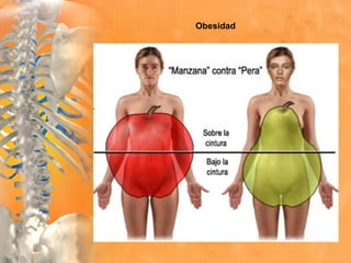Obesidad
 