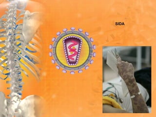 SIDA
 