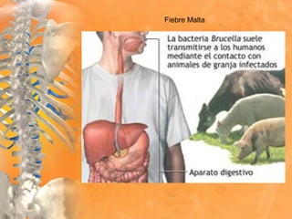 Fiebre Malta
 
