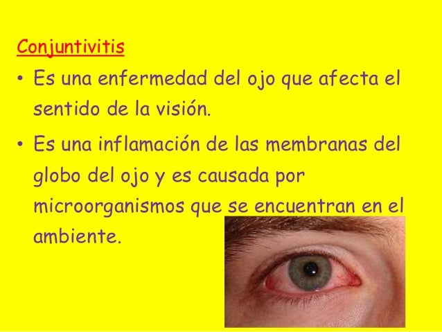 ENFERMEDADES DE LOS SENTIDOS