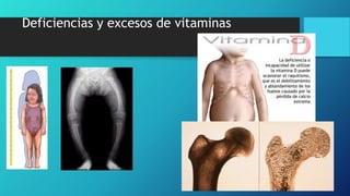 Deficiencias y excesos de vitaminas
 
