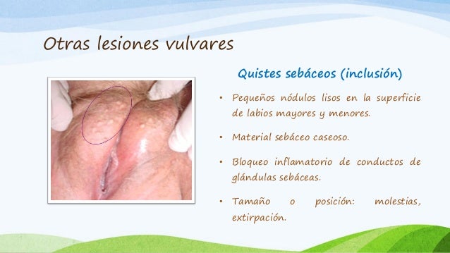 Atopichesky la dermatitis el dolor