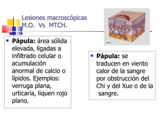 Lesiones macroscópicas
       M.O. Vs MTCH.

   Pápula: área sólida
    elevada, ligadas a
    infiltrado celular o           Pápula: se
    acumulación                     traducen en viento
    anormal de calcio o             calor de la sangre
    lípidos. Ejemplos:              por obstrucción del
    verruga plana,                  Chi y del Xue o de la
    urticaria, liquen rojo           sangre.
    plano.
 