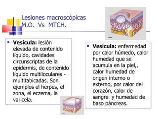 Lesiones macroscópicas
       M.O. Vs MTCH.

   Vesícula: lesión
    elevada de contenido
                                   Vesícula: enfermedad
    líquido, cavidades              por calor húmedo, calor
    circunscriptas de la            humedad que se
    epidermis, de contenido         acumula en la piel,,
    líquido multiloculares -        calor humedad de
    multitabicadas. Son             origen interno o
    ejemplos el herpes, el          externo, por calor del
    zona, el eczema, la             corazón, calor de
    varicela.                       sangre y humedad de
                                    baso páncreas.
 