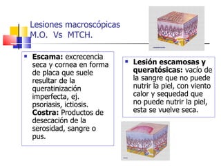 Lesiones macroscópicas
    M.O. Vs MTCH.

   Escama: excrecencia
    seca y cornea en forma
                                Lesión escamosas y
    de placa que suele           queratósicas: vacío de
    resultar de la               la sangre que no puede
    queratinización              nutrir la piel, con viento
    imperfecta, ej.              calor y sequedad que
    psoriasis, ictiosis.         no puede nutrir la piel,
    Costra: Productos de         esta se vuelve seca.
    desecación de la
    serosidad, sangre o
    pus.
 