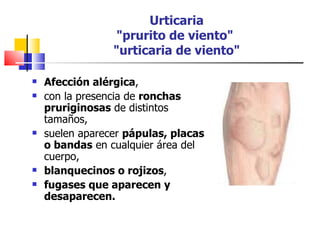 Urticaria
                 "prurito de viento"
                 "urticaria de viento"

   Afección alérgica,
   con la presencia de ronchas
    pruriginosas de distintos
    tamaños,
   suelen aparecer pápulas, placas
    o bandas en cualquier área del
    cuerpo,
   blanquecinos o rojizos,
   fugases que aparecen y
    desaparecen.
 