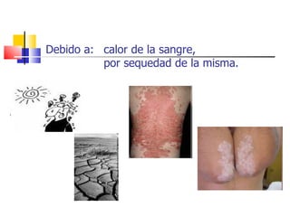 Debido a: calor de la sangre,
          por sequedad de la misma.
 