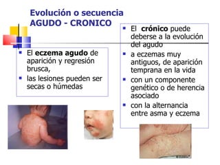 Evolución o secuencia
    AGUDO - CRONICO 
                                  El crónico puede
                                  deberse a la evolución
                                  del agudo
   El eczema agudo de           a eczemas muy
    aparición y regresión         antiguos, de aparición
    brusca,                       temprana en la vida
   las lesiones pueden ser      con un componente
    secas o húmedas               genético o de herencia
                                  asociado
                                 con la alternancia
                                  entre asma y eczema
 