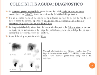COLECISTITIS AGUDA: DIAGNOSTICO <ul><li>La  gammagrafia hepatobiliar  con derivados del  acido iminodiacetico  marcados co...