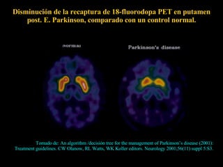 Disminución de la recaptura de 18-fluorodopa PET en putamen post. E. Parkinson, comparado con un control normal. Tomado de: An algorithm /decisión tree for the management of Parkinson’s disease (2001):  Treatment guidelines.  CW Olanow, RL Watts, WK Koller editors. Neurology 2001;56(11) suppl 5:S3.  