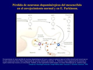 Pérdida de neuronas dopaminérgicas del mesencéfalo  en el envejecimiento normal y en E. Parkinson. Envejecimiento nl: mayor pérdida de neuronas dopaminérgicas de la  pars compacta  sustancia nigra en la hilera dorsal (azul oscuro) que en la zona ventral (azul claro). Mayor degeneración de neuronas mediales que laterales.  E.  Parkinson: mayor degeneración de neuronas en región ventral (rojo oscuro) y en zona lateral. También  en área tegmentaria medial aunque con menor intensidad que en  sustancia nigra. Tomado de: Neurología molecular. Joseph Martin editor. Fascículo 2. Scientific American  1998. 