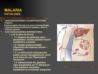 MALARIA
    PATOLOGÍA

   FASE ESQUIZOGÓNICA EXOERITROCITARIA
    (Higado)
    Hepatomegalia discreta con poca sintomatología,
    ocasionalmente insuficiencia hepática, fiebre y
    malestar general.
   FASE ESQUIZOGÓNICA ERITROCITARIA
        1. LOS GLÓBULOS ROJOS
              1.1. Ruptura de glóbulos rojos
              parasitados: acceso palúdico-shock
              anafiláctico y anemia.
             1.2. Hepato-esplenomegalia
              (hipertrofia del sistema retículo –
              endotelial
             1.3. La destrucción intravascular
              puede causar hemoglobinuria como
              en la infección por Plasmodium
              falciparum.
               1.4. Adherenciade los glóbulos
              rojos parasitados por P. falciparum
              a los capilares viscerales
              impidiendo la circulación sanguinea
 