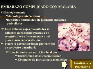 EMBARAZO COMPLICADO CON MALARIA
Histológicamente:
   Macrófagos intervellosos
   Depósitos fibrinoides de pigmento malárico
    perivellosos
 Los Glóbulos rojos parasitados se
  adhieren al endotelio gracias a un
  receptor que se incrementa a nivel
  placentario en la gestación.
 Placenta parece ser lugar preferencial
  de secuestro parasitario
    Interferencia con nutrición fetal por:
         Obstrucción de microcirculación
         Competencia por sustrato metabólico
                                                 Insuficiencia
                                                  Placentaria
 
