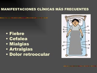 MANIFESTACIONES CLÍNICAS MÁS FRECUENTES




  •   Fiebre
  •   Cefalea
  •   Mialgias
  •   Artralgias
  •   Dolor retroocular
 