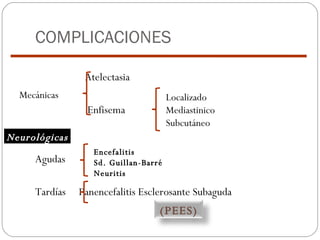 COMPLICACIONES Atelectasia Enfisema Agudas Tardías  Panencefalitis Esclerosante Subaguda Localizado  Mediastinico Subcutáneo Mecánicas Neurológicas Encefalitis Sd. Guillan-Barré Neuritis (PEES) 