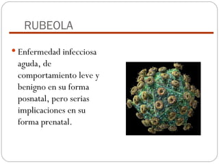 RUBEOLA Enfermedad infecciosa aguda, de comportamiento leve y benigno en su forma posnatal, pero serias implicaciones en su forma prenatal. 