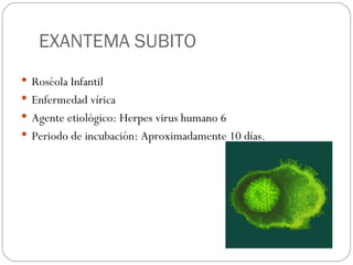 EXANTEMA SUBITO Roséola Infantil Enfermedad vírica Agente etiológico: Herpes virus humano 6 Periodo de incubación: Aproximadamente 10 días. 