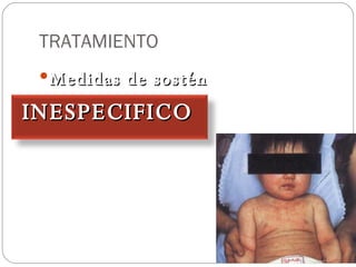 TRATAMIENTO Medidas de sostén INESPECIFICO   