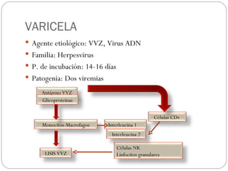 VARICELA Agente etiológico: VVZ, Virus ADN Familia: Herpesvirus P. de incubación: 14-16 días Patogenia: Dos viremias Antígeno VVZ Glicoproteinas Monocitos-Macrofagos Células CD 4   Interleucina 1 Células NK Linfocitos granulares LISIS VVZ Interleucina 2 