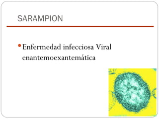 SARAMPION Enfermedad infecciosa Viral enantemoexantemática 