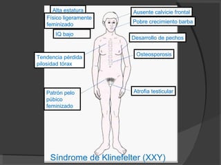 Tema 13: Citogenética Síndrome de Klinefelter (XXY) Atrofia testicular Osteosporosis Desarrollo de pechos Tendencia pérdida pilosidad tórax  Alta estatura Físico ligeramente feminizado IQ bajo Patrón pelo  púbico feminizado Ausente calvicie frontal Pobre crecimiento barba 