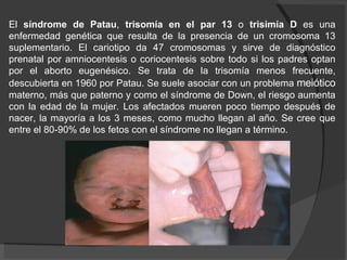 El  síndrome de Patau ,  trisomía en el par 13  o  trisimía D  es una enfermedad genética que resulta de la presencia de un cromosoma 13 suplementario. El cariotipo da 47 cromosomas y sirve de diagnóstico prenatal por amniocentesis o coriocentesis sobre todo si los padres optan por el aborto eugenésico. Se trata de la trisomía menos frecuente, descubierta en 1960 por Patau. Se suele asociar con un problema  meiótico  materno, más que paterno y como el síndrome de Down, el riesgo aumenta con la edad de la mujer. Los afectados mueren poco tiempo después de nacer, la mayoría a los 3 meses, como mucho llegan al año. Se cree que entre el 80-90% de los fetos con el síndrome no llegan a término. 
