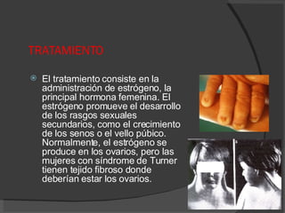 TRATAMIENTO El tratamiento consiste en la administración de estrógeno, la principal hormona femenina. El estrógeno promueve el desarrollo de los rasgos sexuales secundarios, como el crecimiento de los senos o el vello púbico. Normalmente, el estrógeno se produce en los ovarios, pero las mujeres con síndrome de Turner tienen tejido fibroso donde deberían estar los ovarios.  