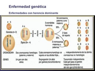 Enfermedad genética Enfermedades con herencia dominante 