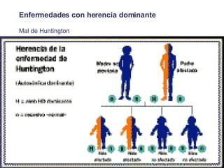 Enfermedades con herencia dominante Mal de Huntington 