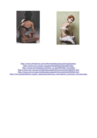 http://www.dmedicina.com/enfermedades/psiquiatricas/bulimia
http://www.cus-usuaris.org/ais/temadelmes/tema03.html
http://www.enciclopedia.cat/fitxa_v2.jsp?NDCHEC=0127003
http://www.nlm.nih.gov/medlineplus/spanish/ency/article/000341.htm
http://www.nlm.nih.gov/medlineplus/spanish/ency/article/000362.htm
http://my.clevelandclinic.org/es_/disorders/anorexia_nervosa/hic_anorexia_nervosa.aspx
 