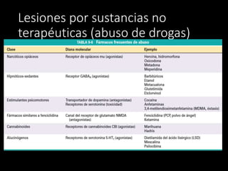 Lesiones por sustancias no 
terapéuticas (abuso de drogas) 
 