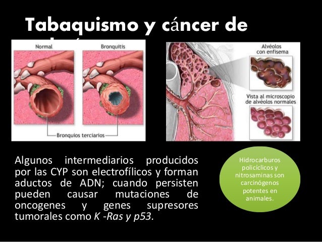 Las consecuencias del alcoholismo para la edad temprana